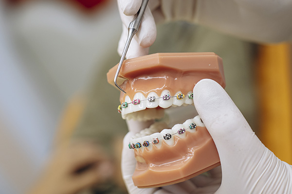 Implante Dentário