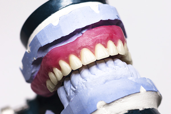 Prótese Dentária